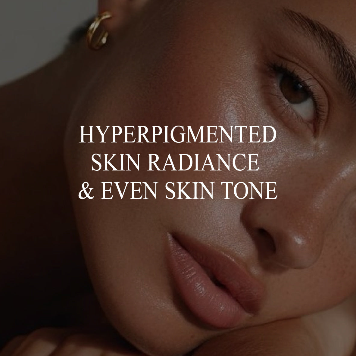 Hyperpigmented skin