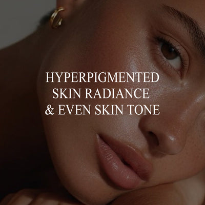 PEAU À HYPERPIGMENTATION